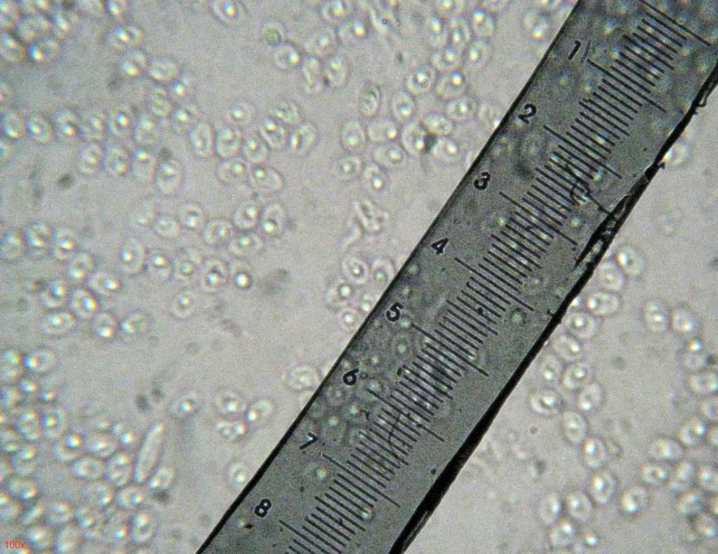 Steccherinum?
